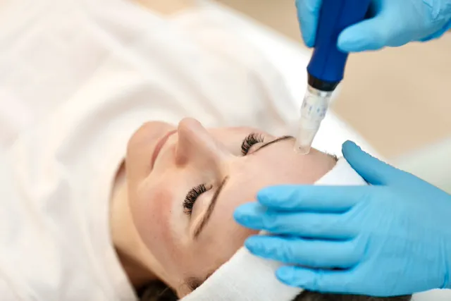 Skinpen / Ar behandling